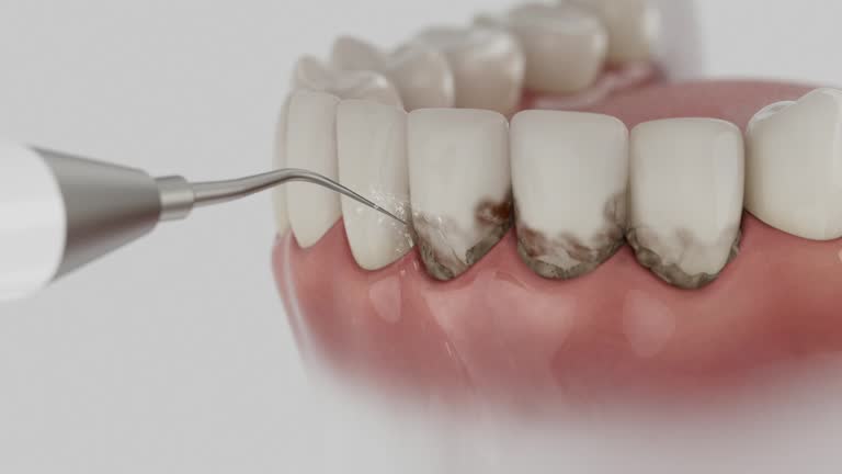 Trusted Tooth Extraction service in Tulare, CA - Dentist Open Now